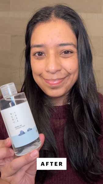 Foresto after applying the Round Lab 1025 Dokdo Toner